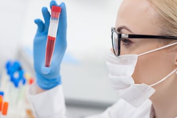 exame de sangue para hipertensão